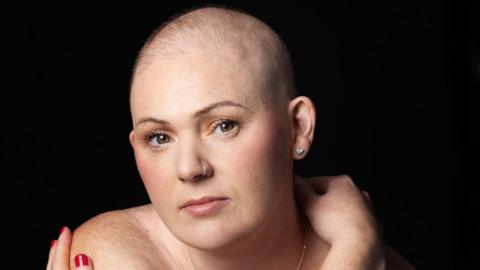 Rhiannon looking into the camera with a thoughtful expression on her face. She is almost completely bald.  She has a silver hoop nose ring and silver heart stud earrings.